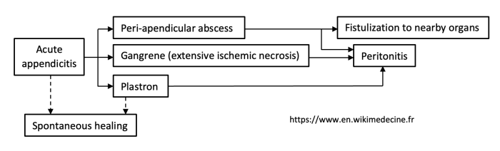 Appendicitis - evolution